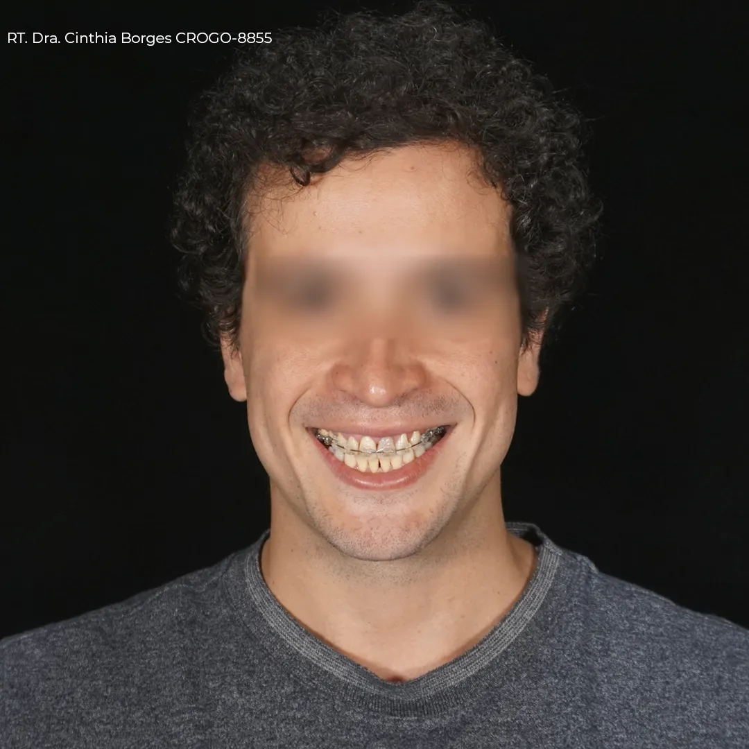 paciente-pos-operatorio02